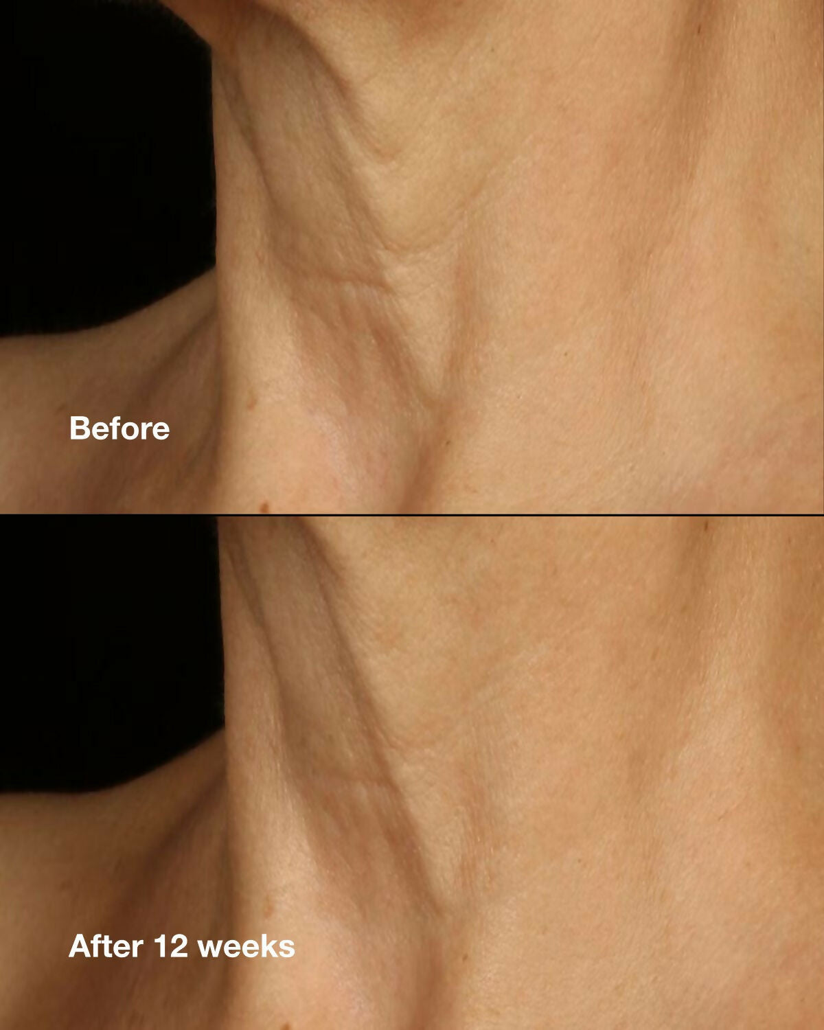 Clinique Smart Clinical Repair Lifting Face & Neck Cream - Grab2buy