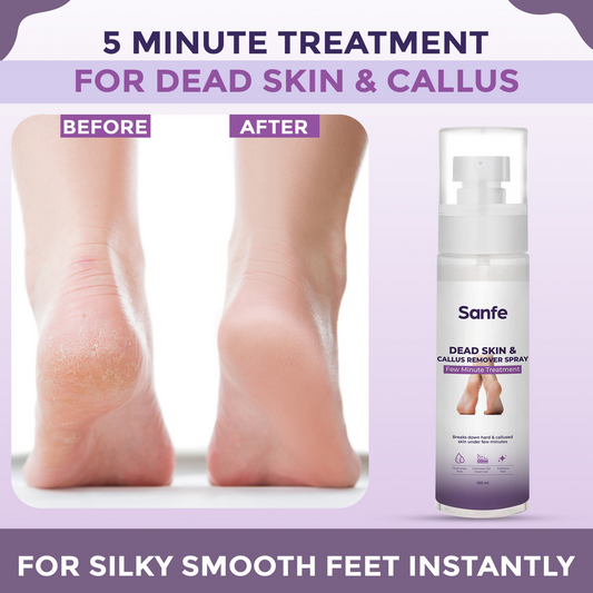 Sanfe Dead Skin & Callus Remover Spray Grab2Buy Sanfe Grab2Buy
