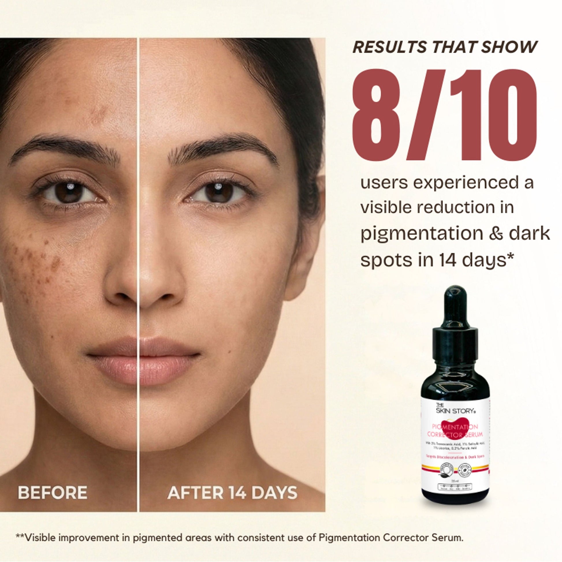 The Skin Story Anti Pigmentation Face Serum For Brighter Skin, Dark Spots, Niacinamide Alpha Arbutin  Grab2Buy The Skin Story Grab2Buy