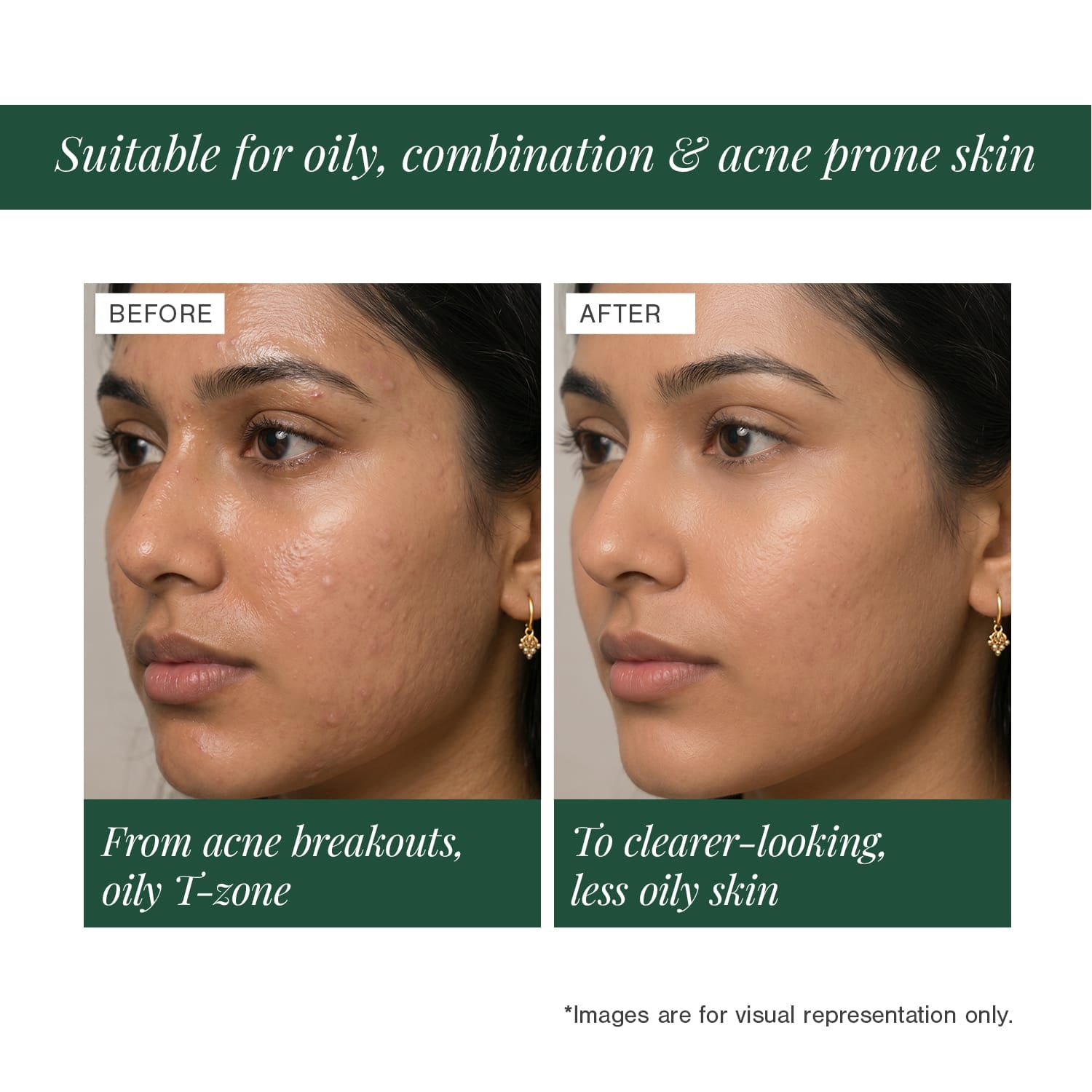 10% Niacinamide + 2% Ectoin Face Serum 