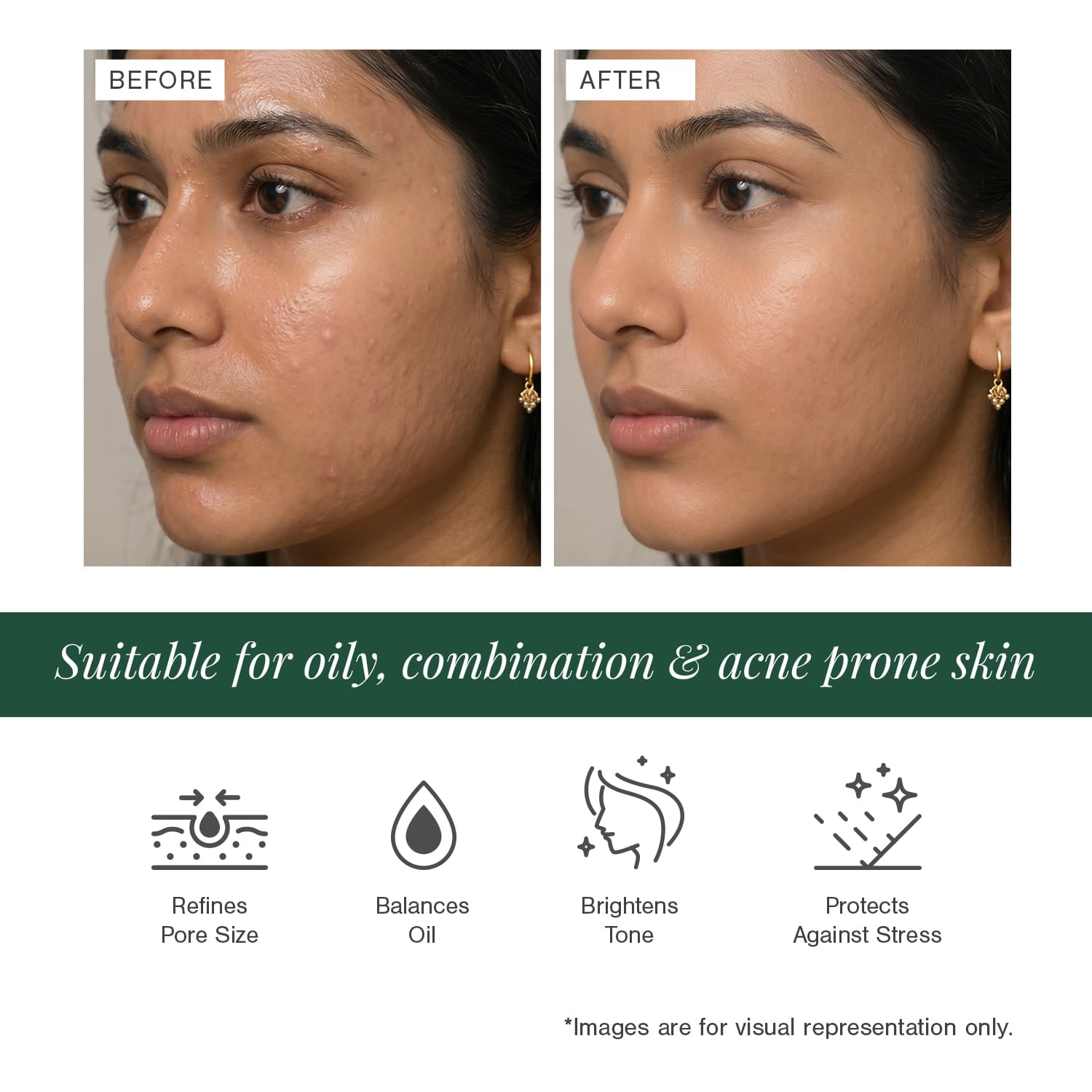 10% Niacinamide + 2% Ectoin Face Serum 