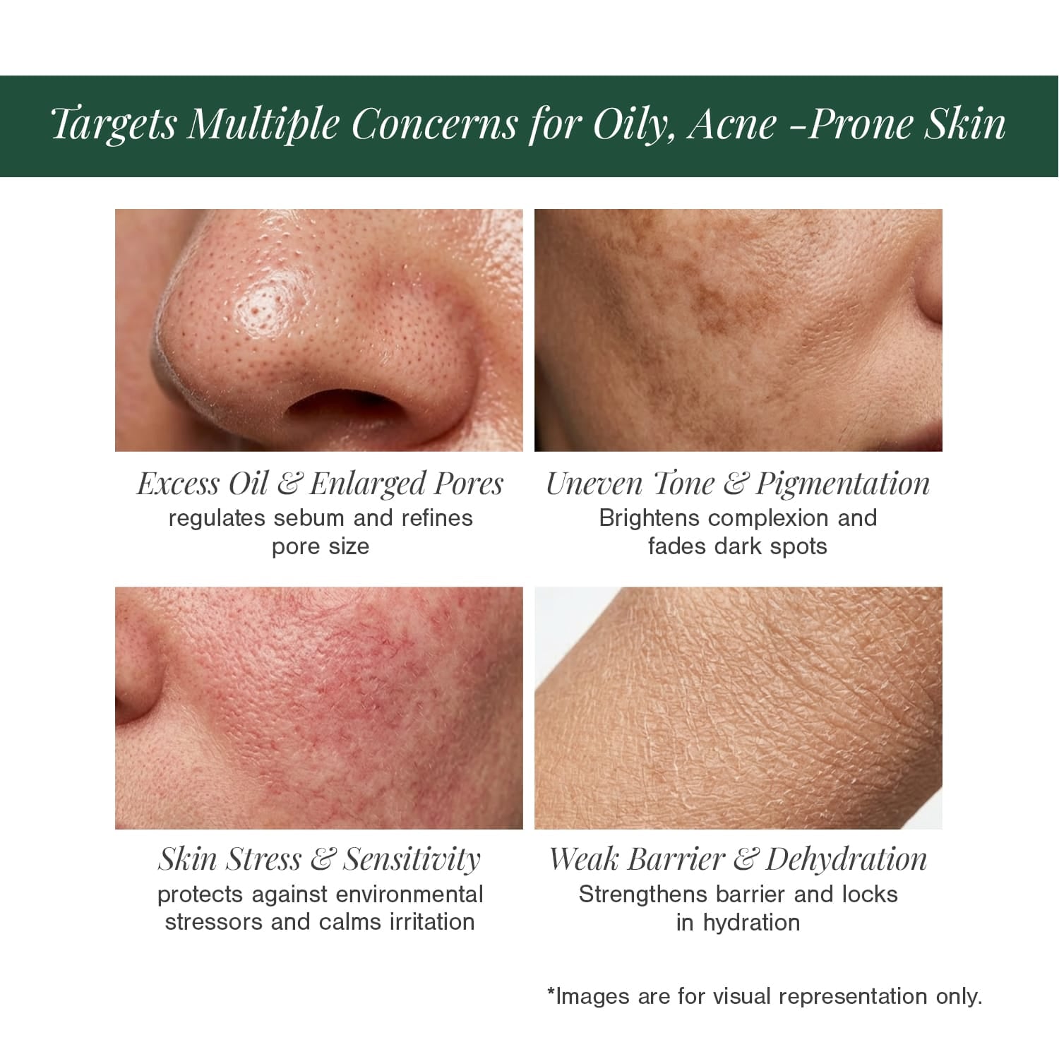 10% Niacinamide + 2% Ectoin Face Serum 