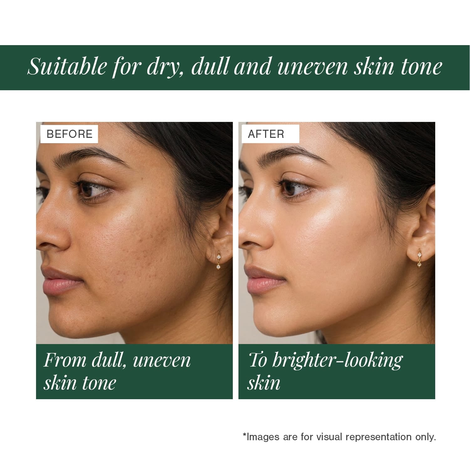 10% Vitamin C + EGCG Face Serum 