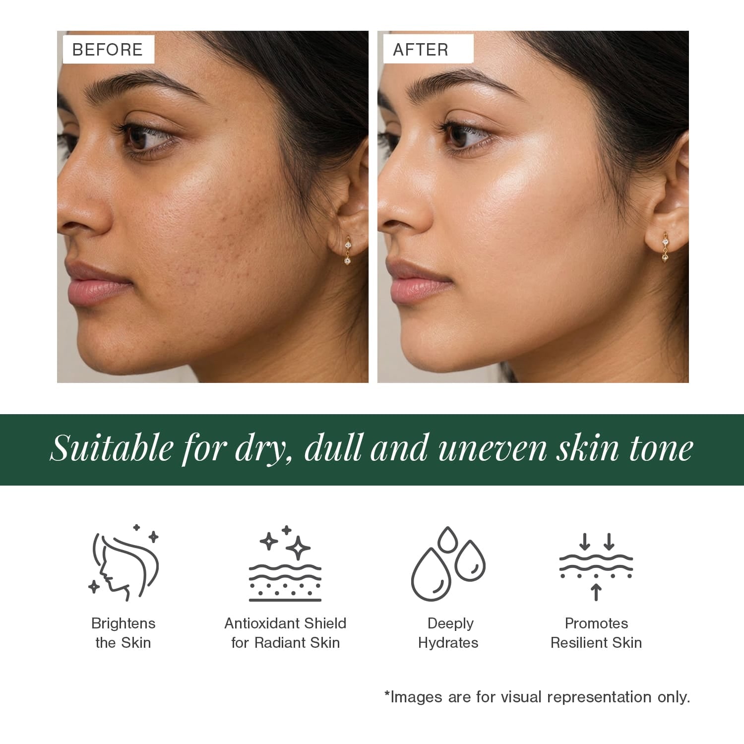 10% Vitamin C + EGCG Face Serum 