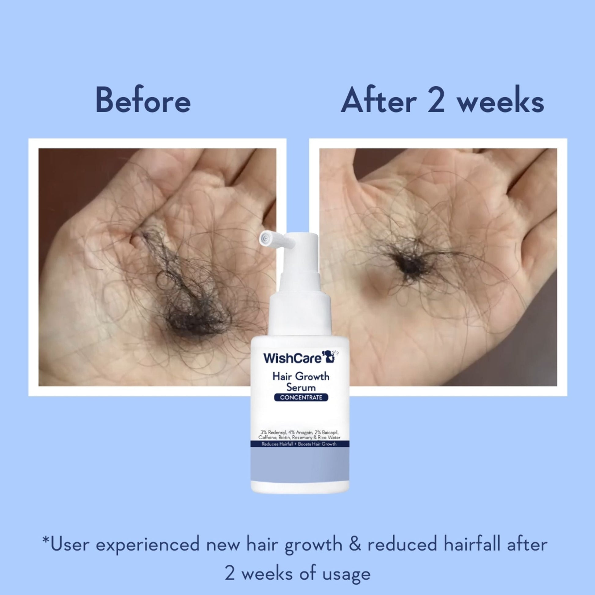 Wishcare Hair Growth Serum Concentrate In-Vivo Tested Redensyl, Anagain, Biotin,Keratin & Rice Water  Grab2Buy Wishcare Grab2Buy