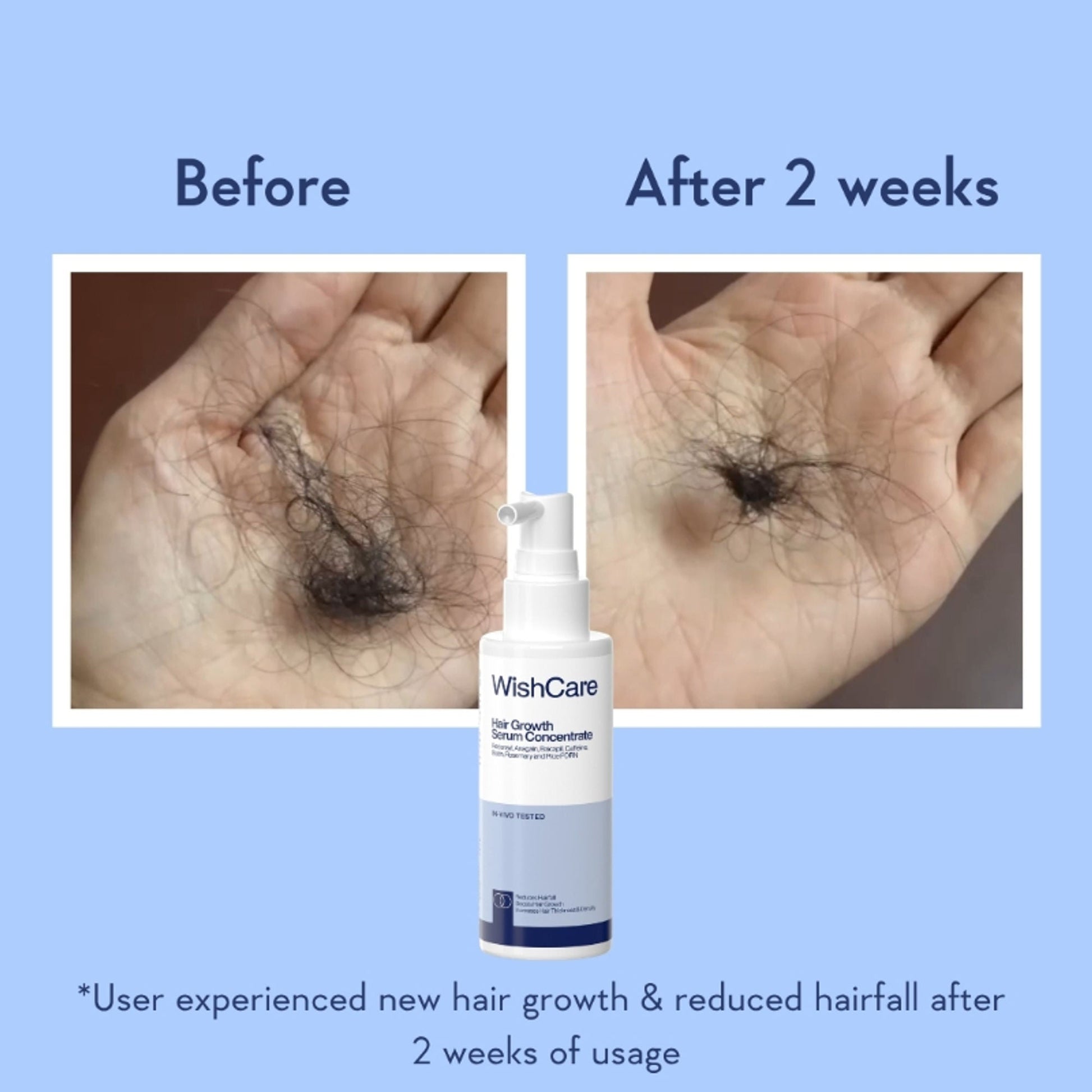 WishCare Hair Growth Serum Concentrate with Redensyl & Rosemary-In-Vivo Tested-Controls Hairfall  Grab2Buy Wishcare Grab2Buy