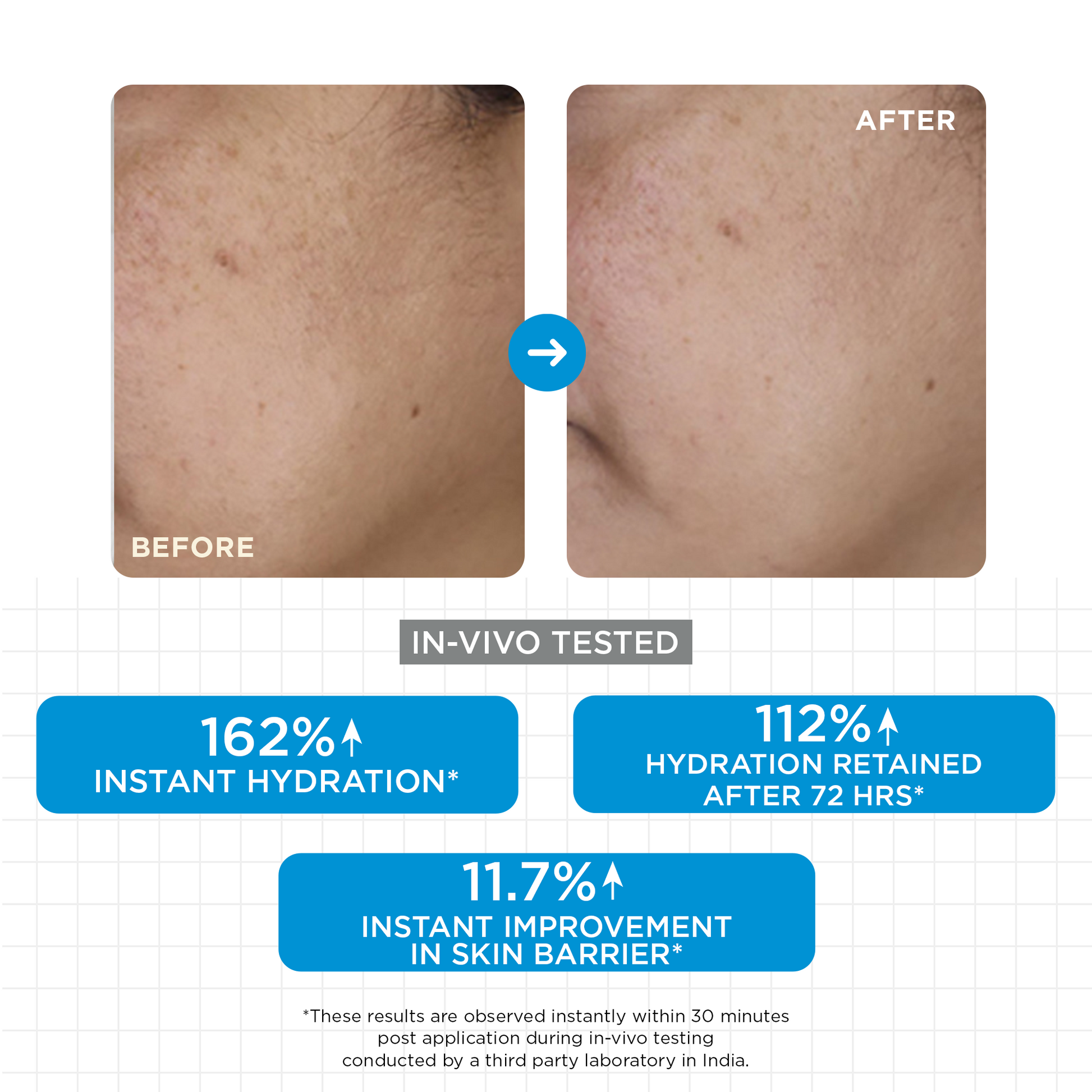 SkinQ Moisture Balm