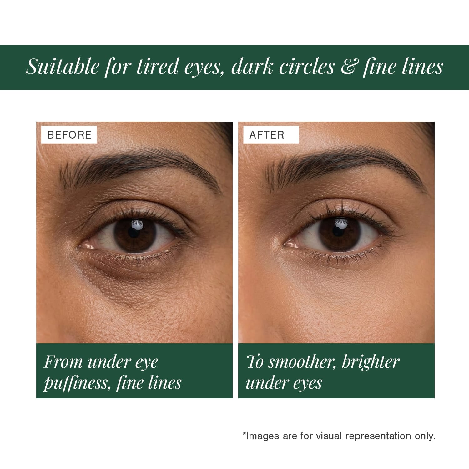 3% Caffeine + Peptides Eye Serum 