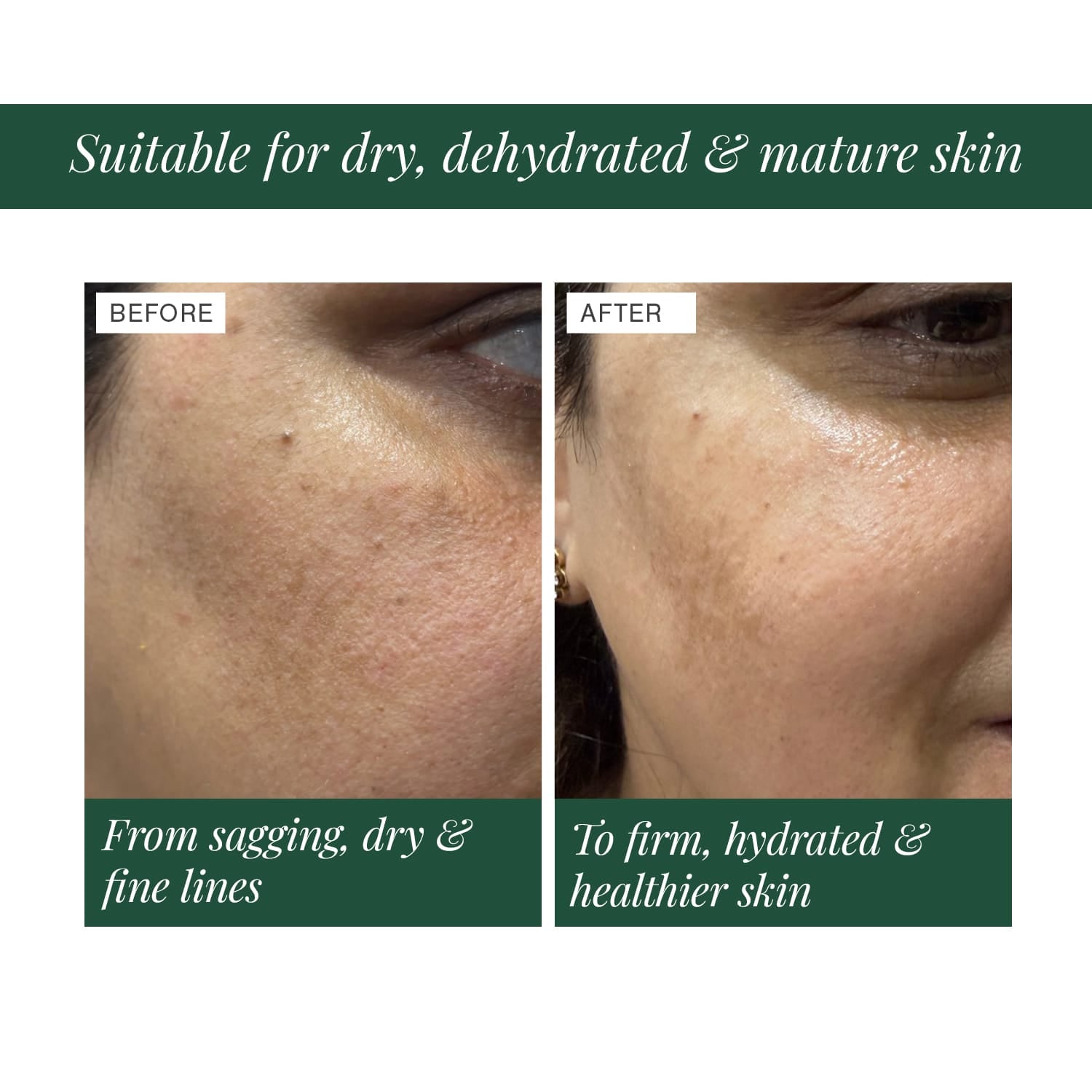 3% Ceramide Complex + Copper Peptide Face Serum 