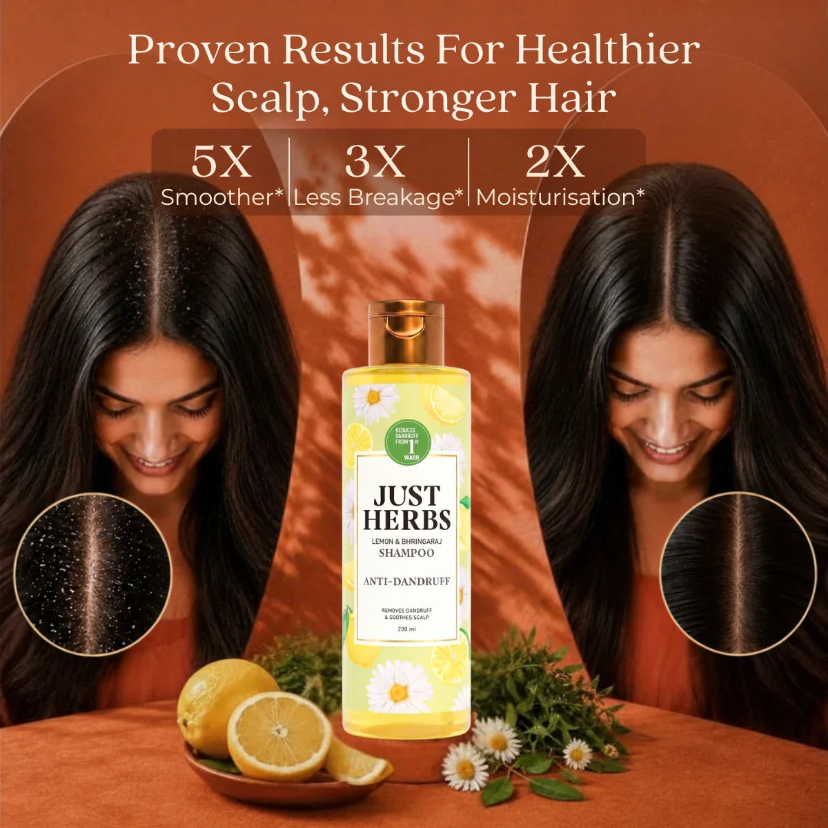 Anti Dandruff Shampoo | Lemon, Bhringraj & 12 Herbs 