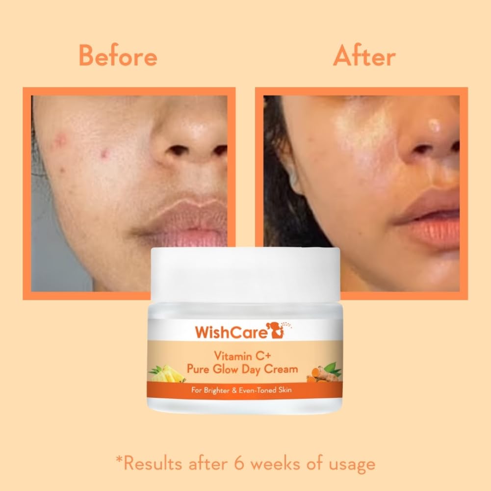 Wishcare Vitamin C+ Pure Glow Face Cream  Grab2Buy Wishcare Grab2Buy