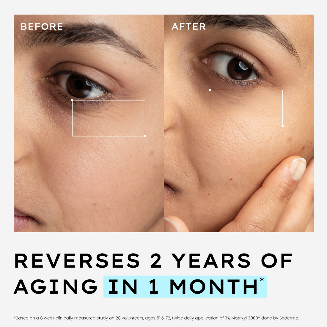 Hyphen 10% Power Peptide Cocktail Serum 