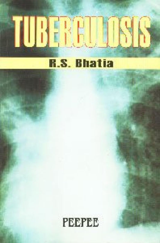 Tuberculosis: Volume 1-RS Bhatia  Grab2Buy Peepee Publishers Grab2Buy