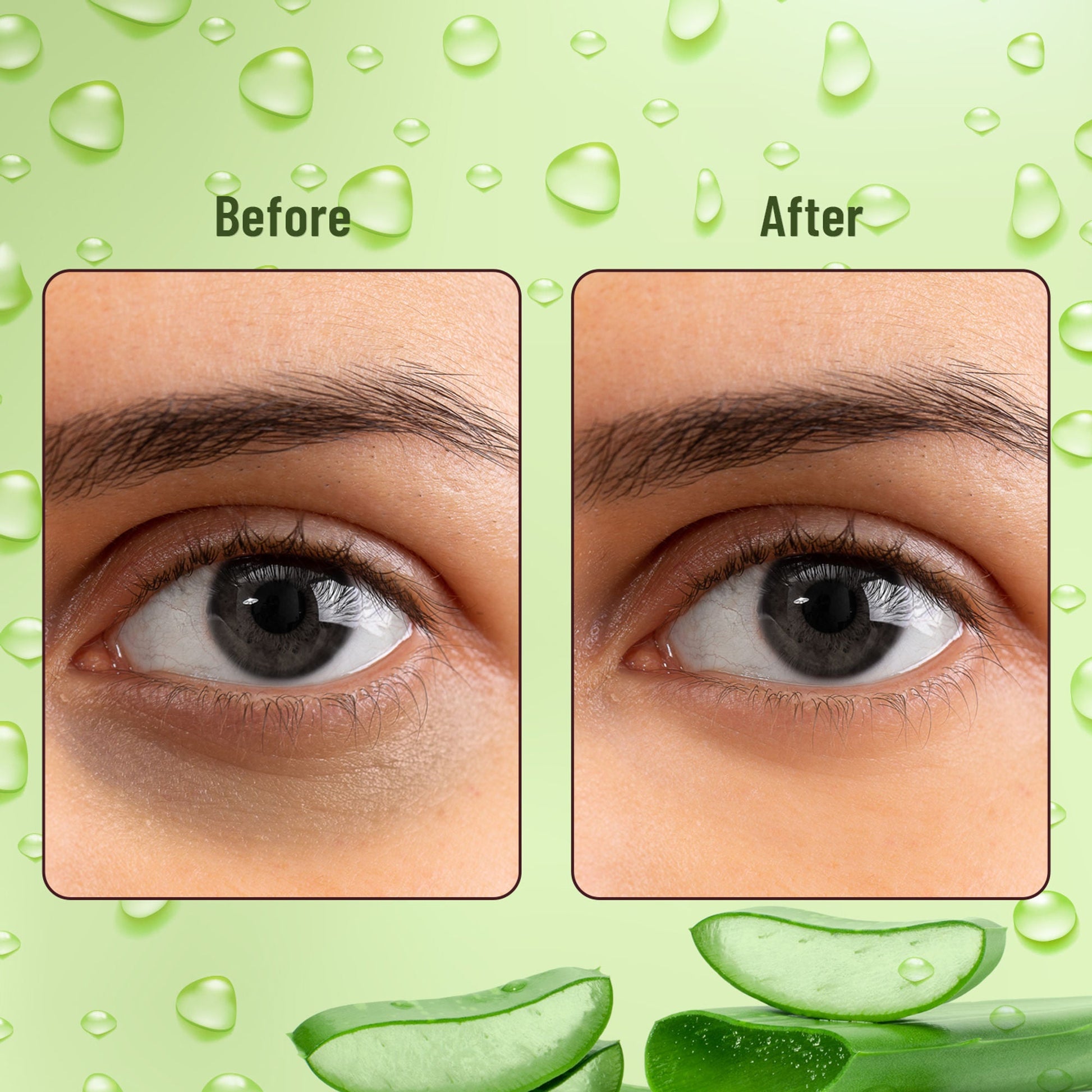 Swiss Beauty Hydra Eye Serum Patches For Dark Circles And Puffiness , Hydrate Skin - Alove Vera