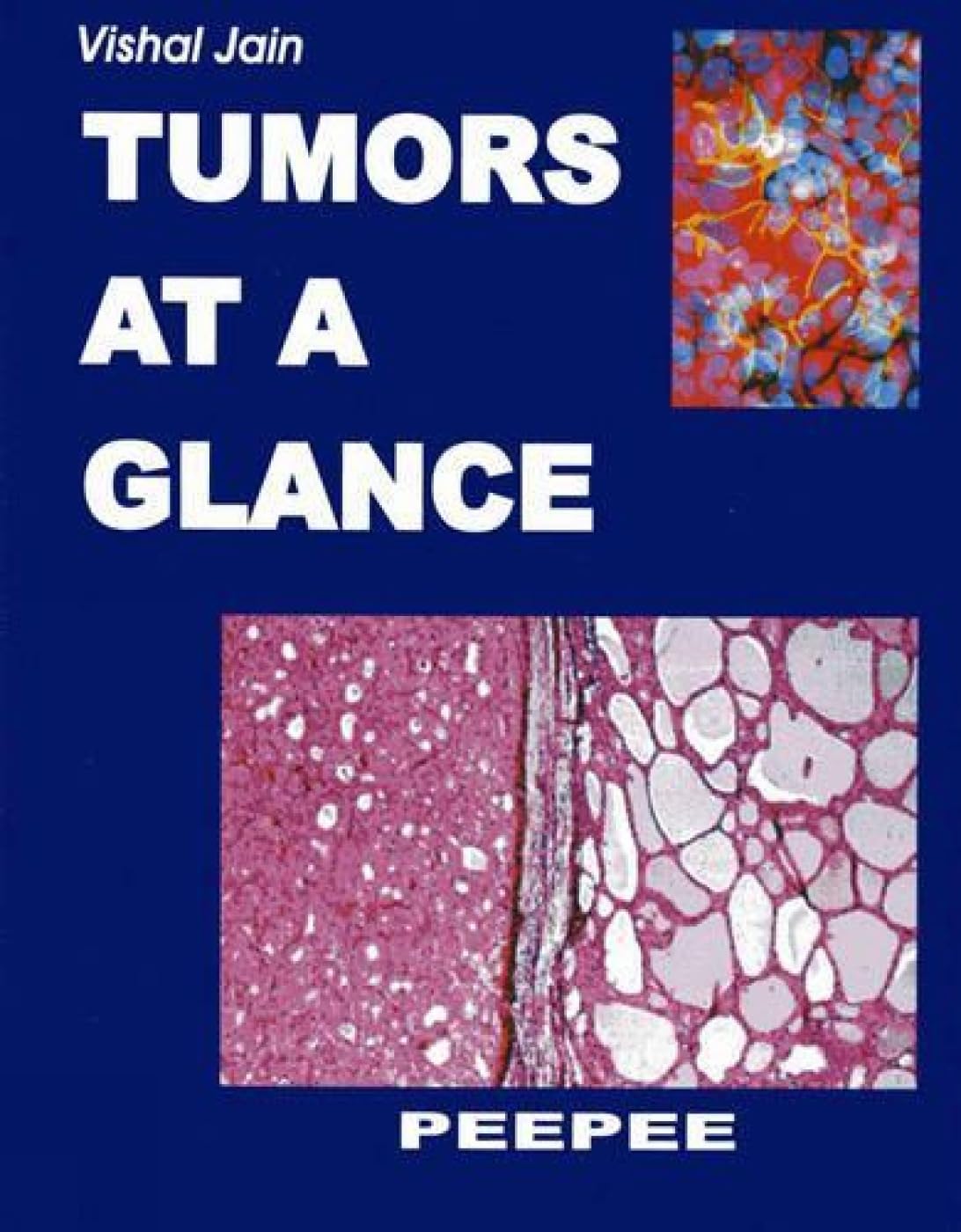 Tumors At A Glance: Volume 1-V K Jain  Grab2Buy Peepee Publishers Grab2Buy