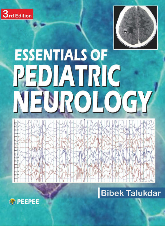 Essentials Of Pediatric Neurology 3E-Talukdar, Bibek