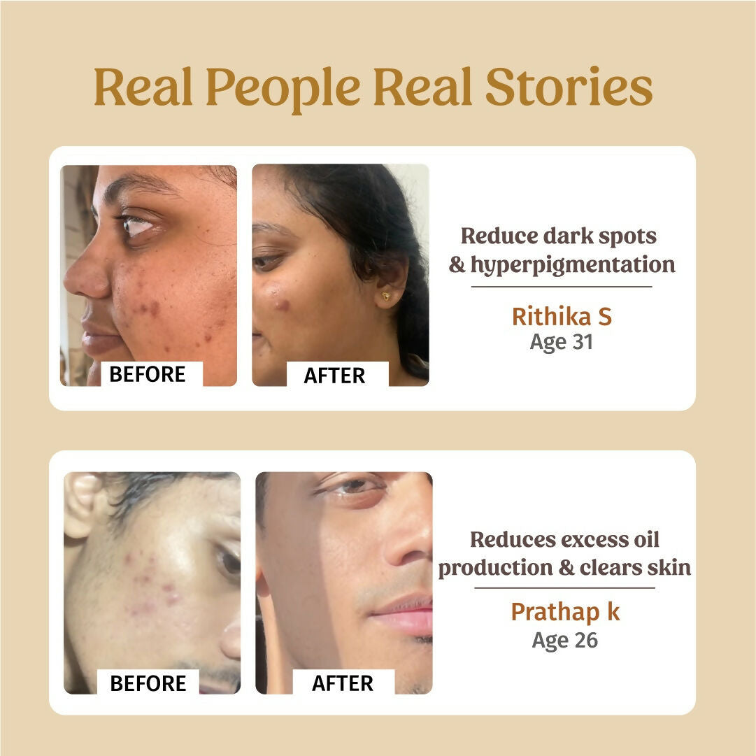 Vilvah Store Skin Hydration Kit  Grab2Buy Vilvah Store Grab2Buy
