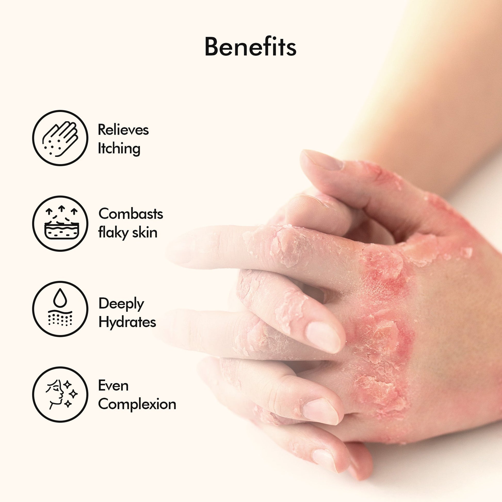 Vedicderm Psoriasis Cream with 2% Bakuchi Extract  Grab2Buy VedicDerm Grab2Buy