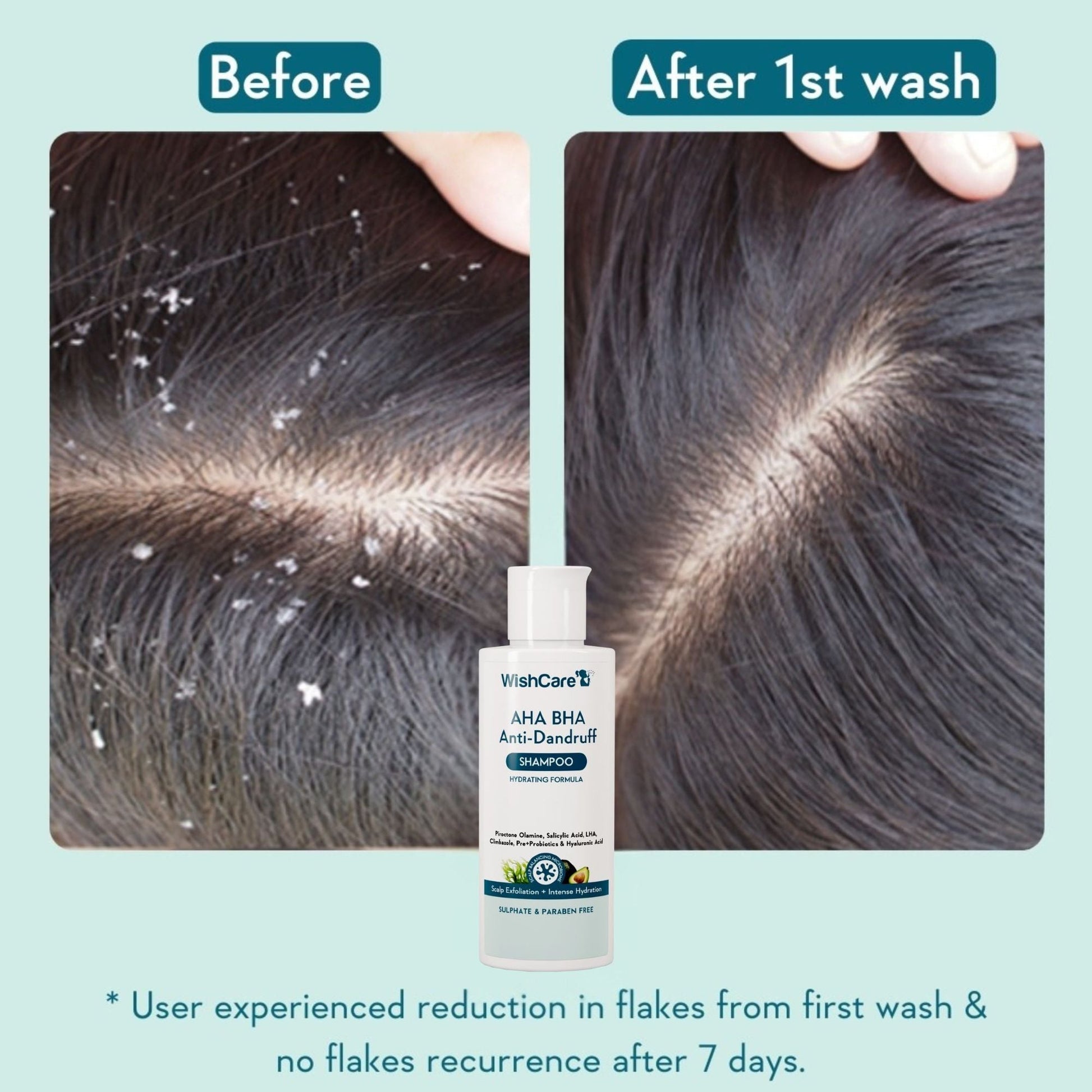 WishCare Hydrating AHA BHA Anti Dandruff Shampo-Reduces Flakes & Itchiness-100% Dandruff Reduction  Grab2Buy Wishcare Grab2Buy