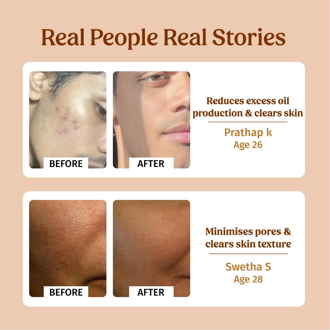 Vilvah Store Milk Face Toner (Earth marine water - Pore minimise)  Grab2Buy Vilvah Store Grab2Buy