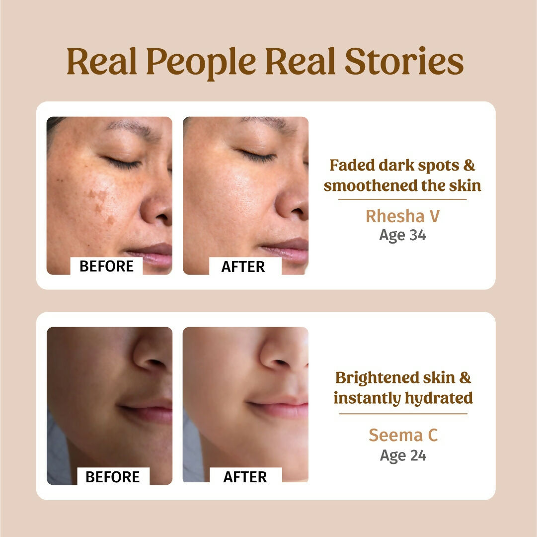 Vilvah Store Ultra Moisturising Cream (Fine lines & Wrinkles)  Grab2Buy Vilvah Store Grab2Buy
