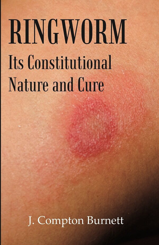 Ringworm: Its Constitutional Nature and Cure - Gyan Books