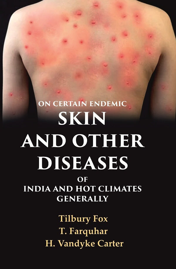 On Certain Endemic Skin and Other Diseases of India and Hot Climates Generally - Gyan Books 