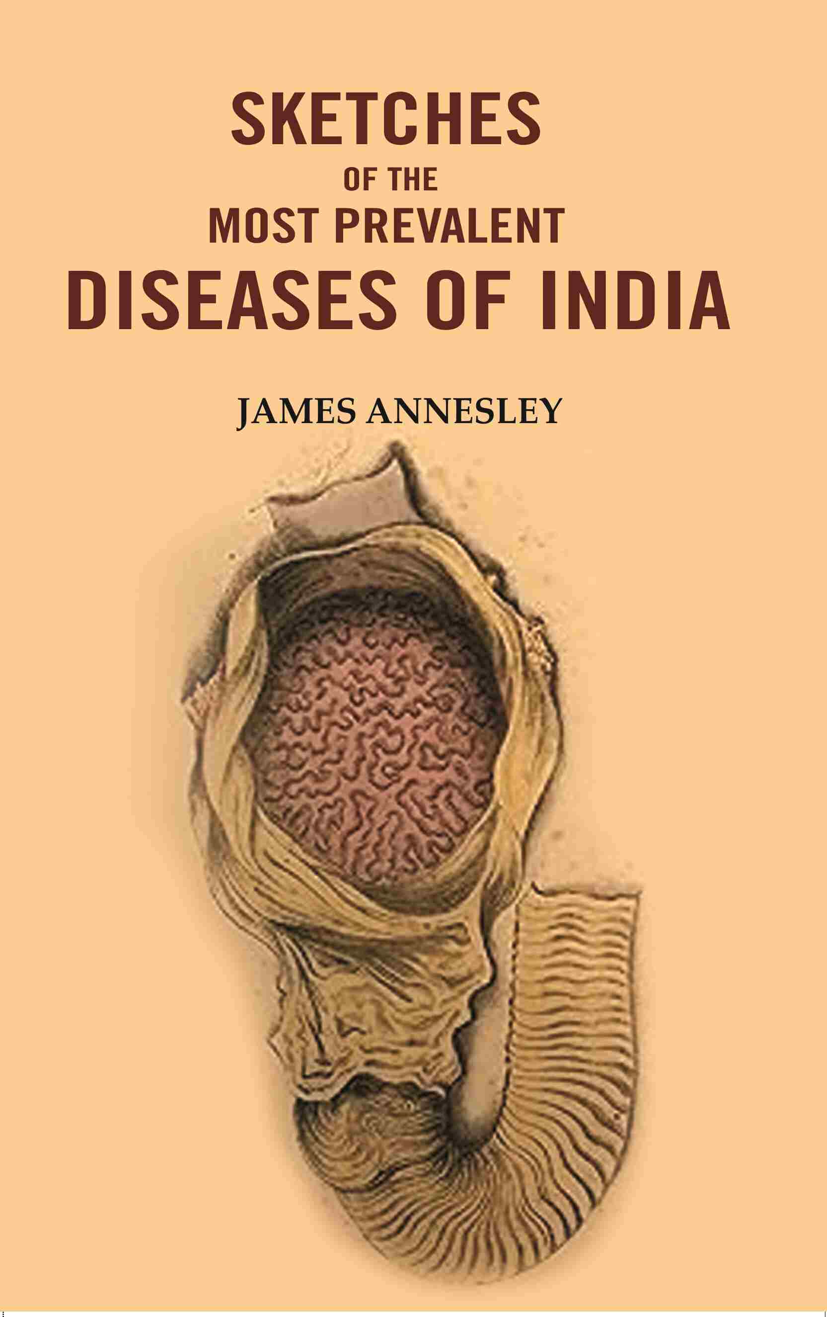 Sketches of the Most Prevalent Diseases of India - Gyan Books 