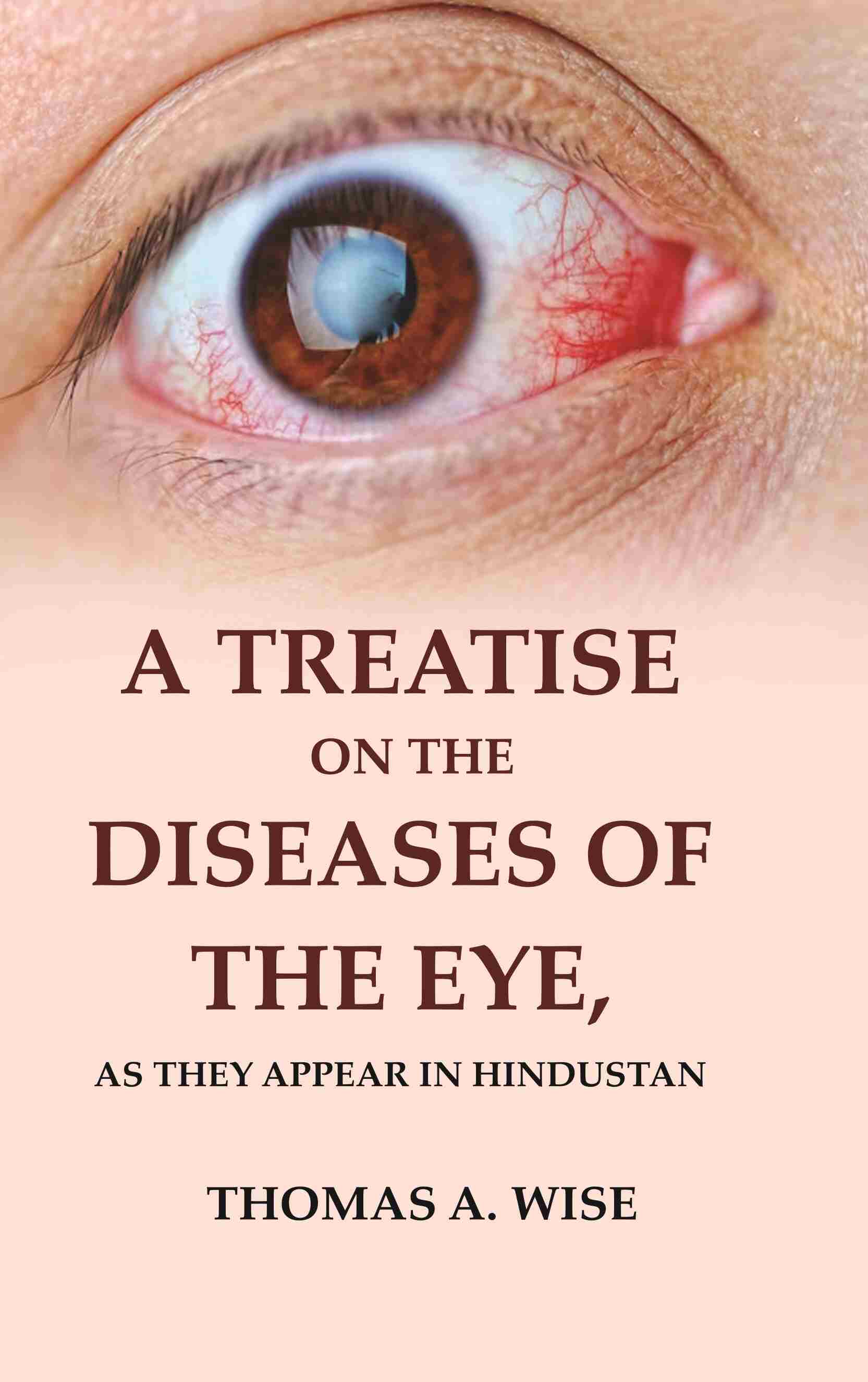 A Treatise on the Diseases of The Eye: As they appear in Hindustan - Gyan Books 