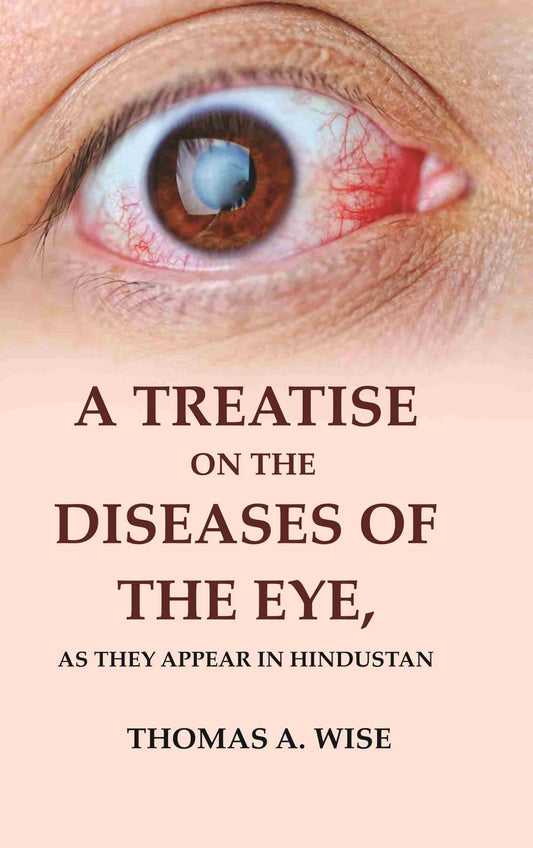 A Treatise on the Diseases of The Eye: As they appear in Hindustan - Gyan Books 