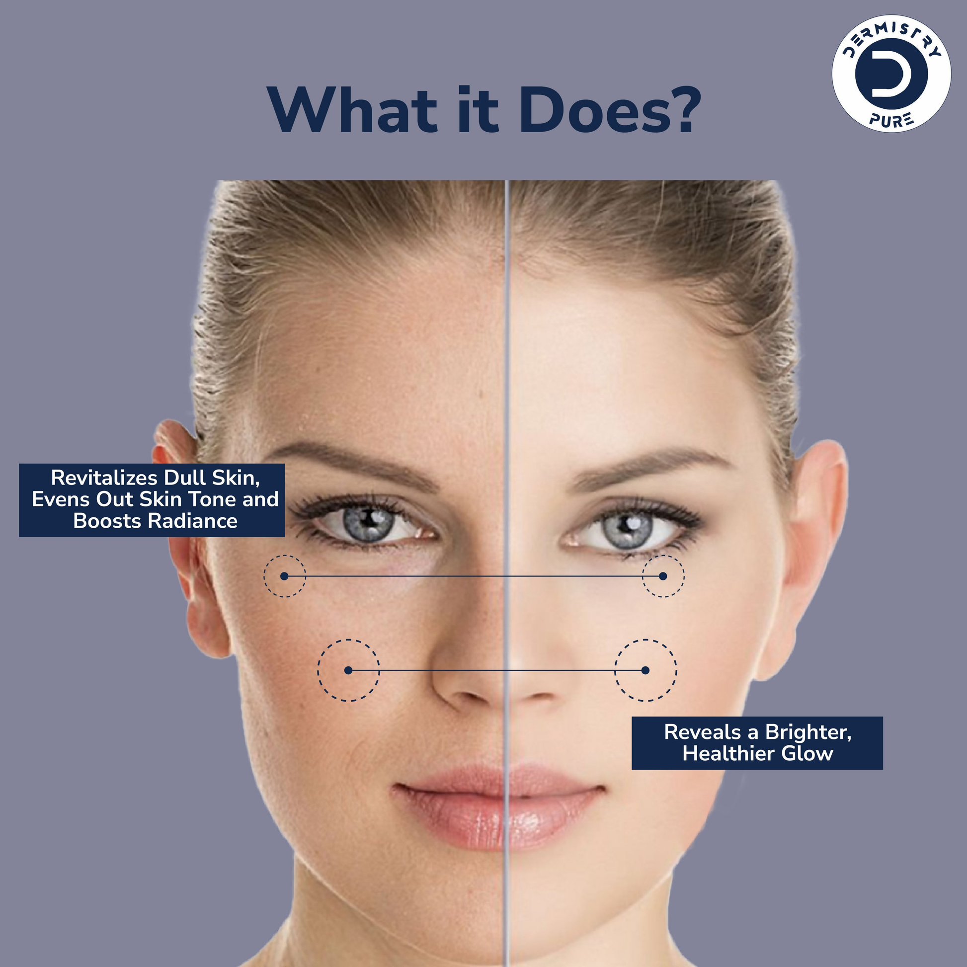 Dermistry 10% Vitamin C 1% Alpha Arbutin Dull Skin Brightening Lightening Fairness Glow Face Serum 