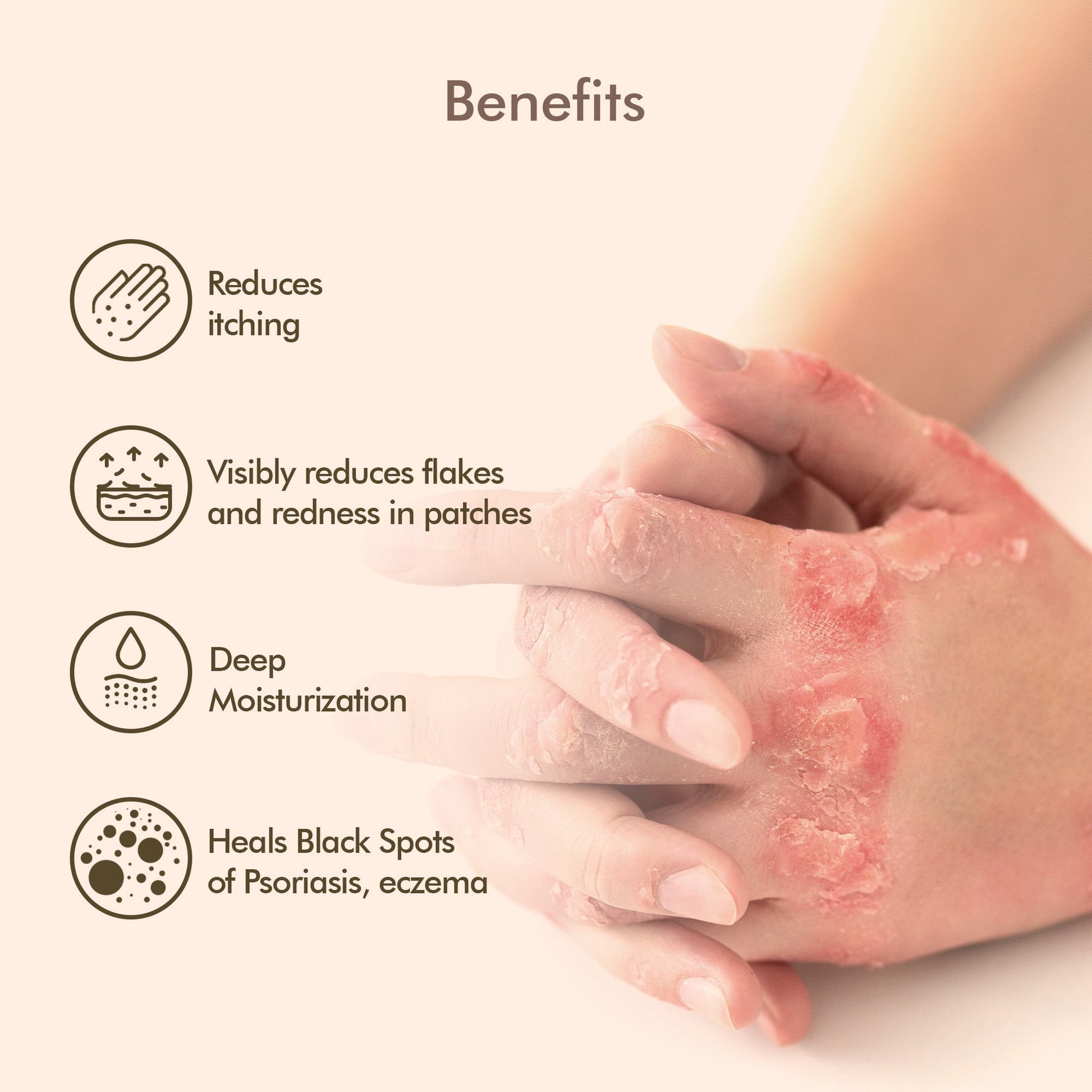 VedicDerm Oleander's Oil for Psoriasis, Eczema, and Atopic Dermatitis  Grab2Buy VedicDerm Grab2Buy