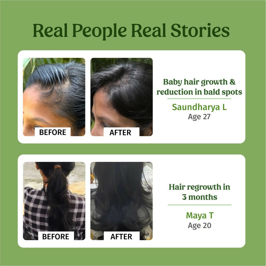 Vilvah Store Hair Growth Oil (Baby Hair Growth)  Grab2Buy Vilvah Store Grab2Buy