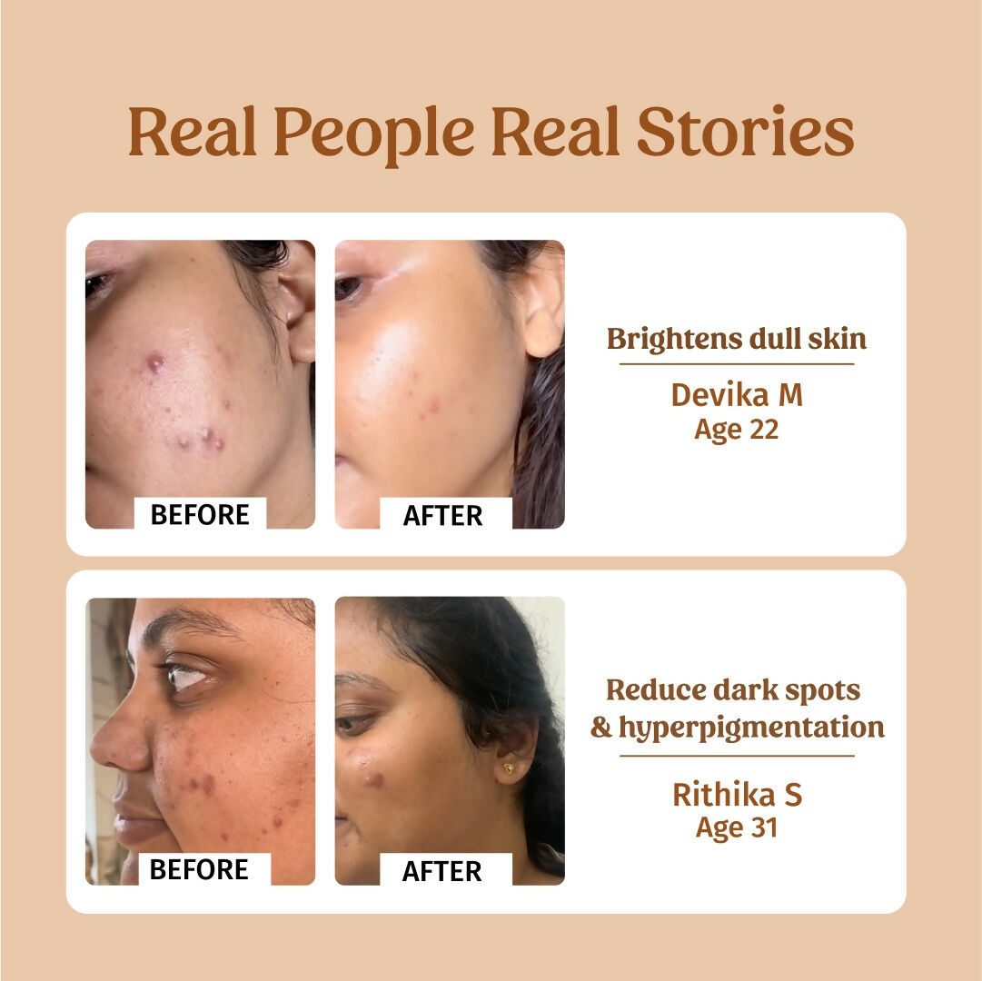 Vilvah Store Milk Drops Brightening Serum (Skin Brightening)  Grab2Buy Vilvah Store Grab2Buy