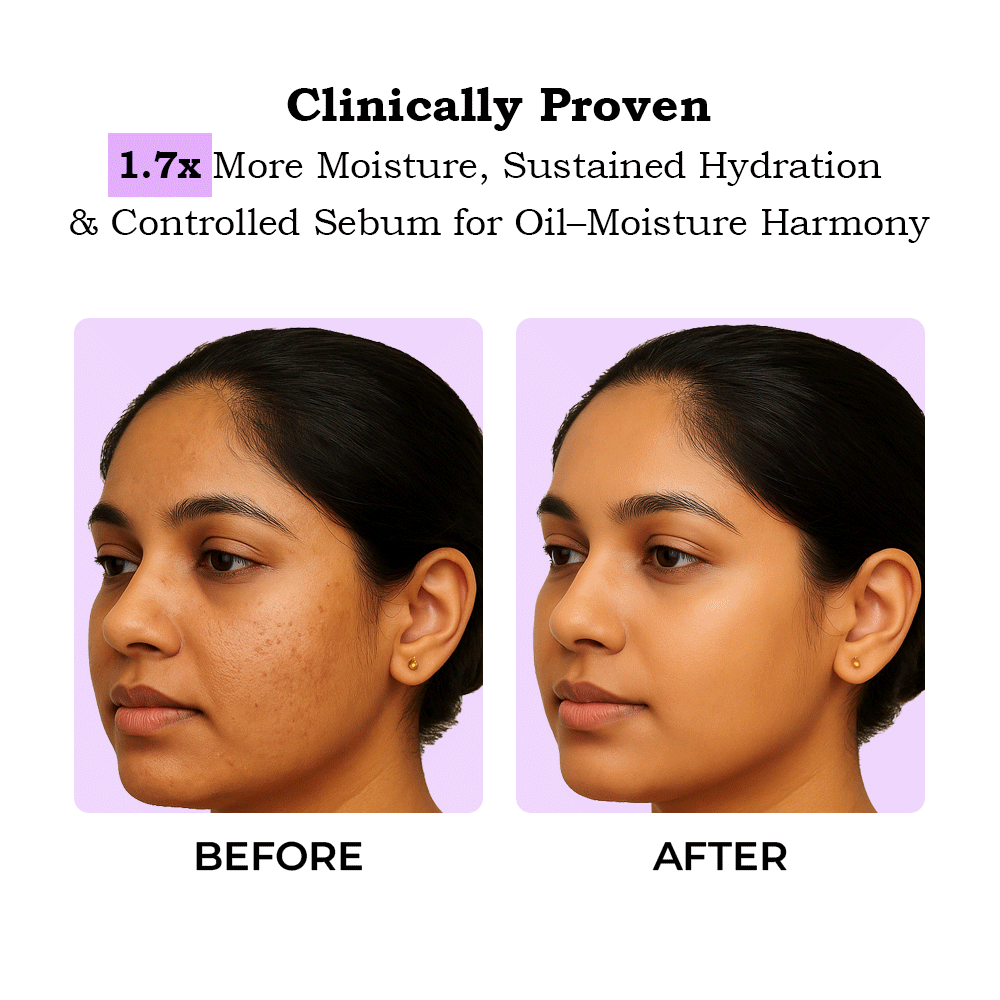 TYC Ceramide Moisturizer  Grab2Buy TYC Grab2Buy