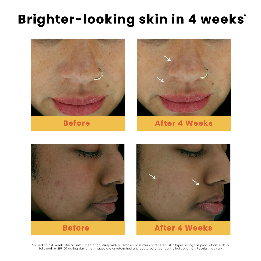 Dark Spot Clearing Turmeric Face Serum 