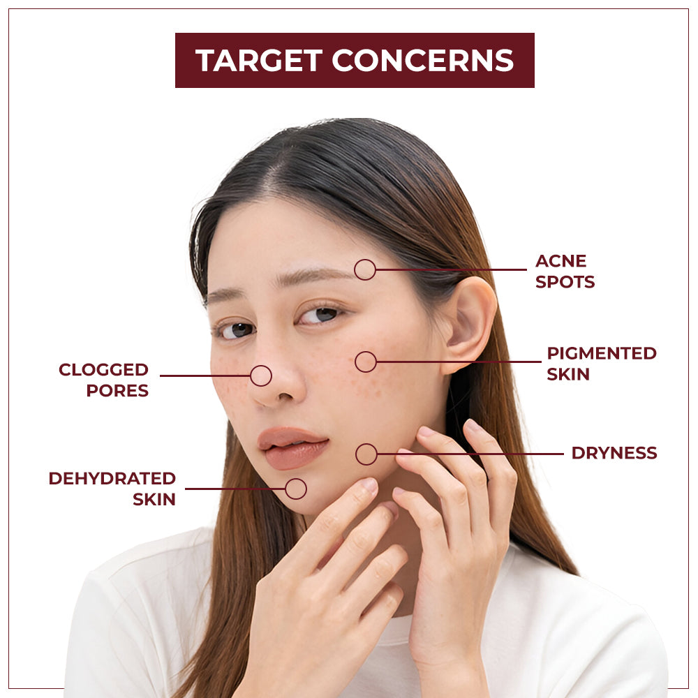 TYC Depigmentation Gel with 4% AHA For Men and Women  Grab2Buy TYC Grab2Buy