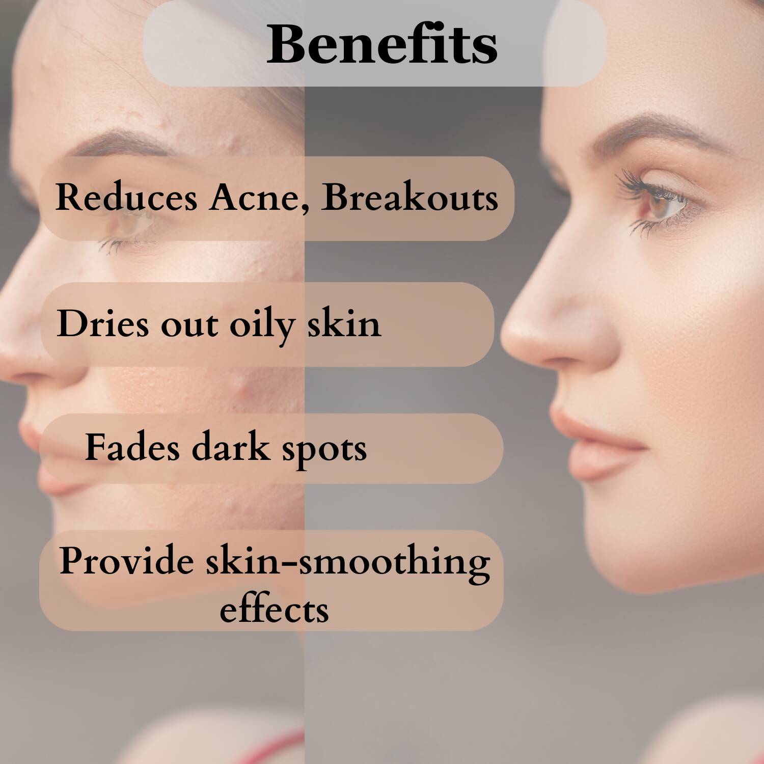 Dermistry Salicylic Acid Anti Acne Face Serum & Anti Acne Foaming Face Wash 