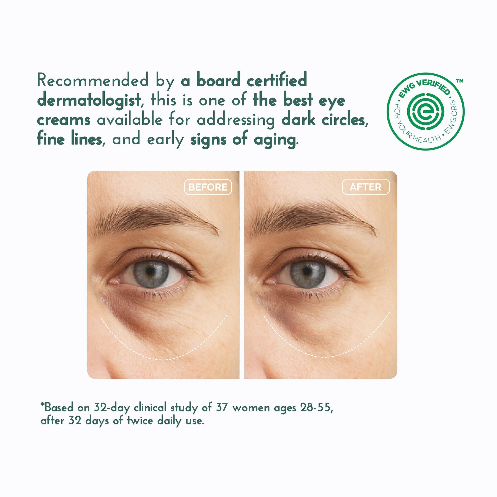 Eye & Neck Cream for Dark Circles and Wrinkles 