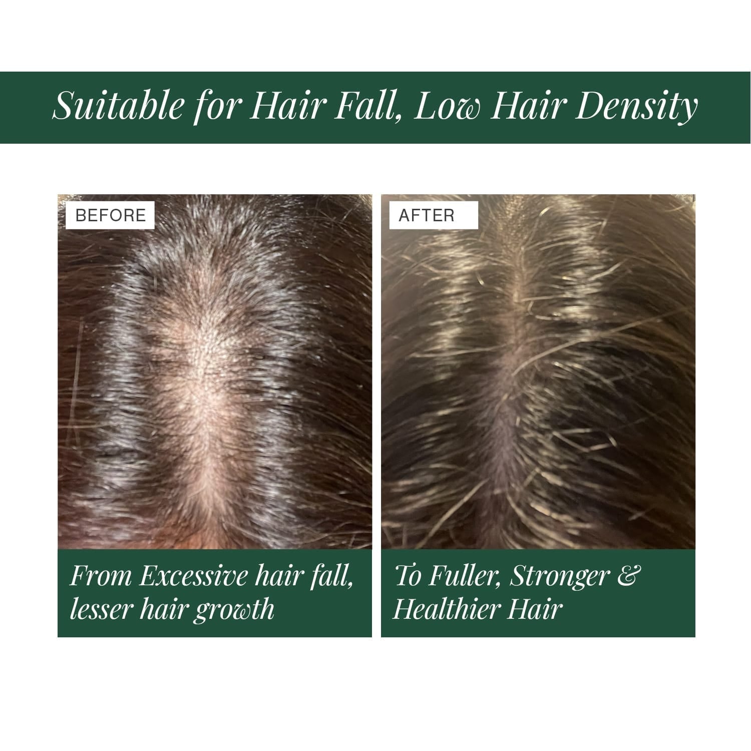 Hair Oil for Premature Greying Fortified with Hibiscus + Bhringaraj 