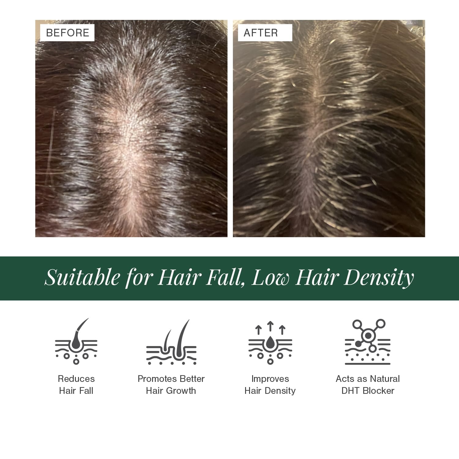 Hair Oil for Premature Greying Fortified with Hibiscus + Bhringaraj 