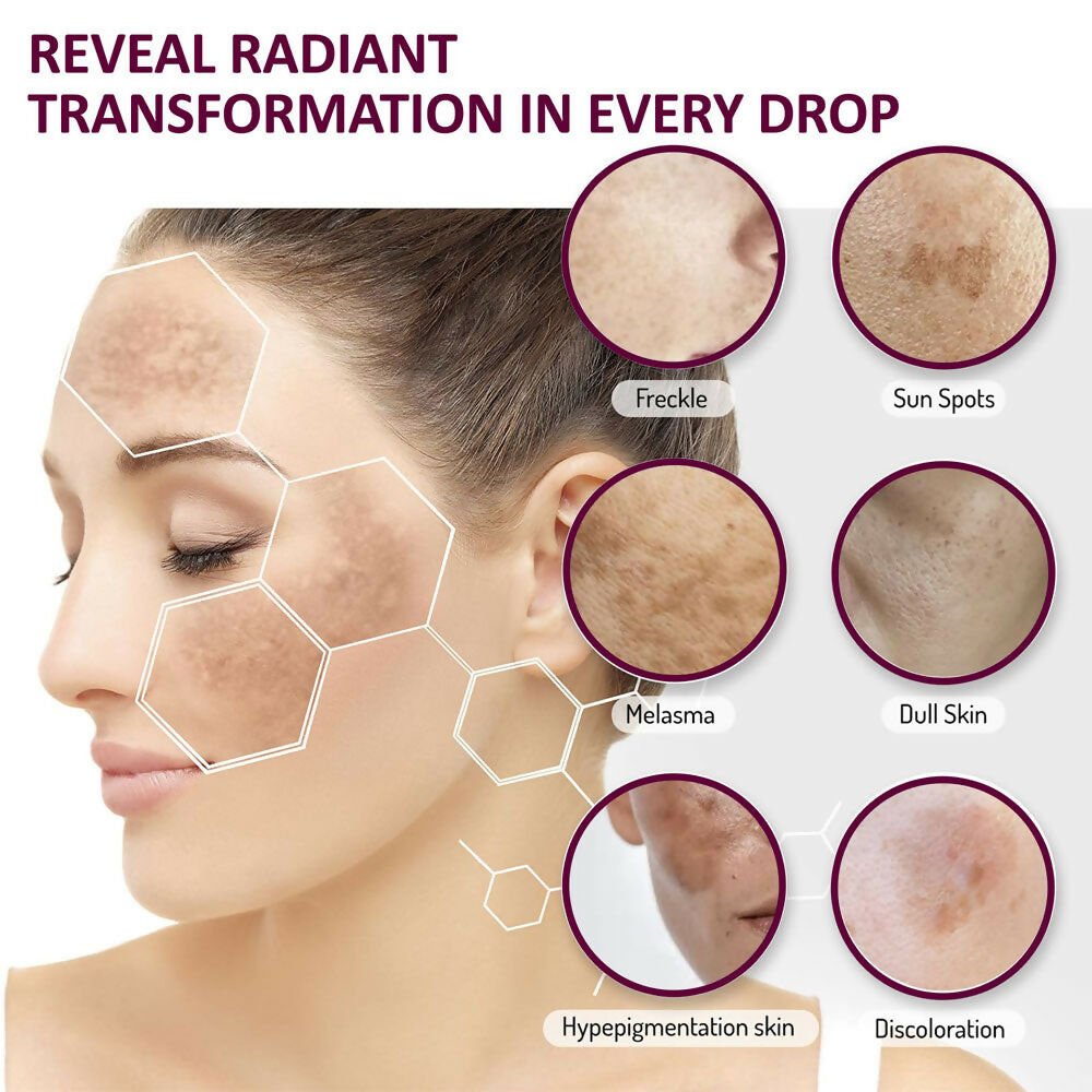 7 Days Dark Spot Reduction Serum 