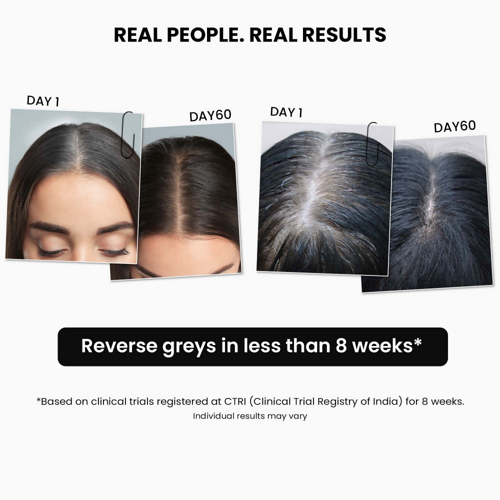 ThriveCo AntiGreying Hair Prime Serum - Reverses Premature Greying Colour 
