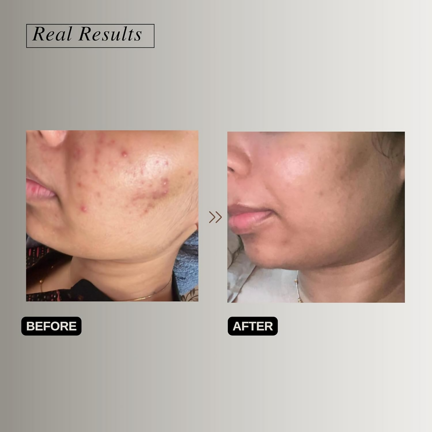 The Formularx Hydra Veil Malazia Hyaluronic Acid Gel Moisturizer  Grab2Buy The Formularx Grab2Buy