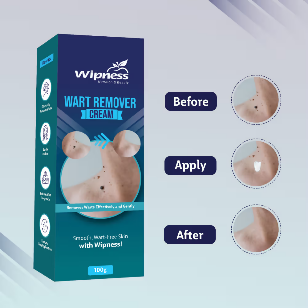 Wipness Natural Wart Remover Cream For Men & Women  Grab2Buy Wipness Grab2Buy