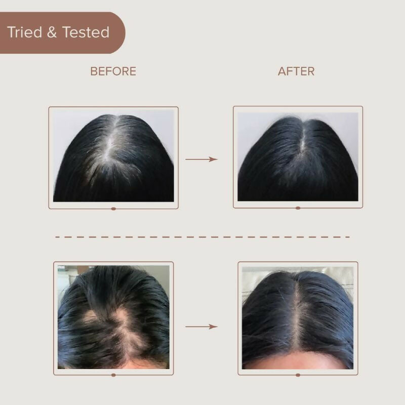 Dromen & Co Ayurvedic Hair Brew Oil With Fusion Of 15 Herbs