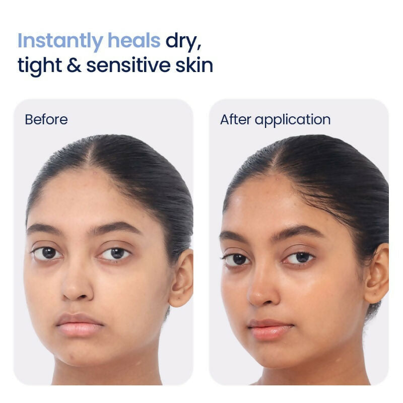 Wishcare 3:1:1 Barrier Bounce Moisturizer with Non-Comedogenic  Grab2Buy Wishcare Grab2Buy