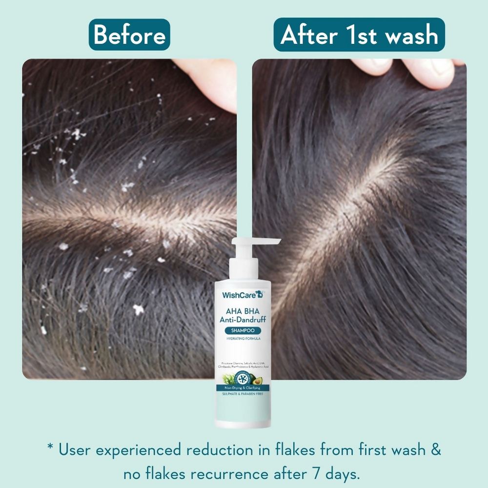 WishCare Aha Bha Anti-Dandruff Shampoo  Grab2Buy Wishcare Grab2Buy