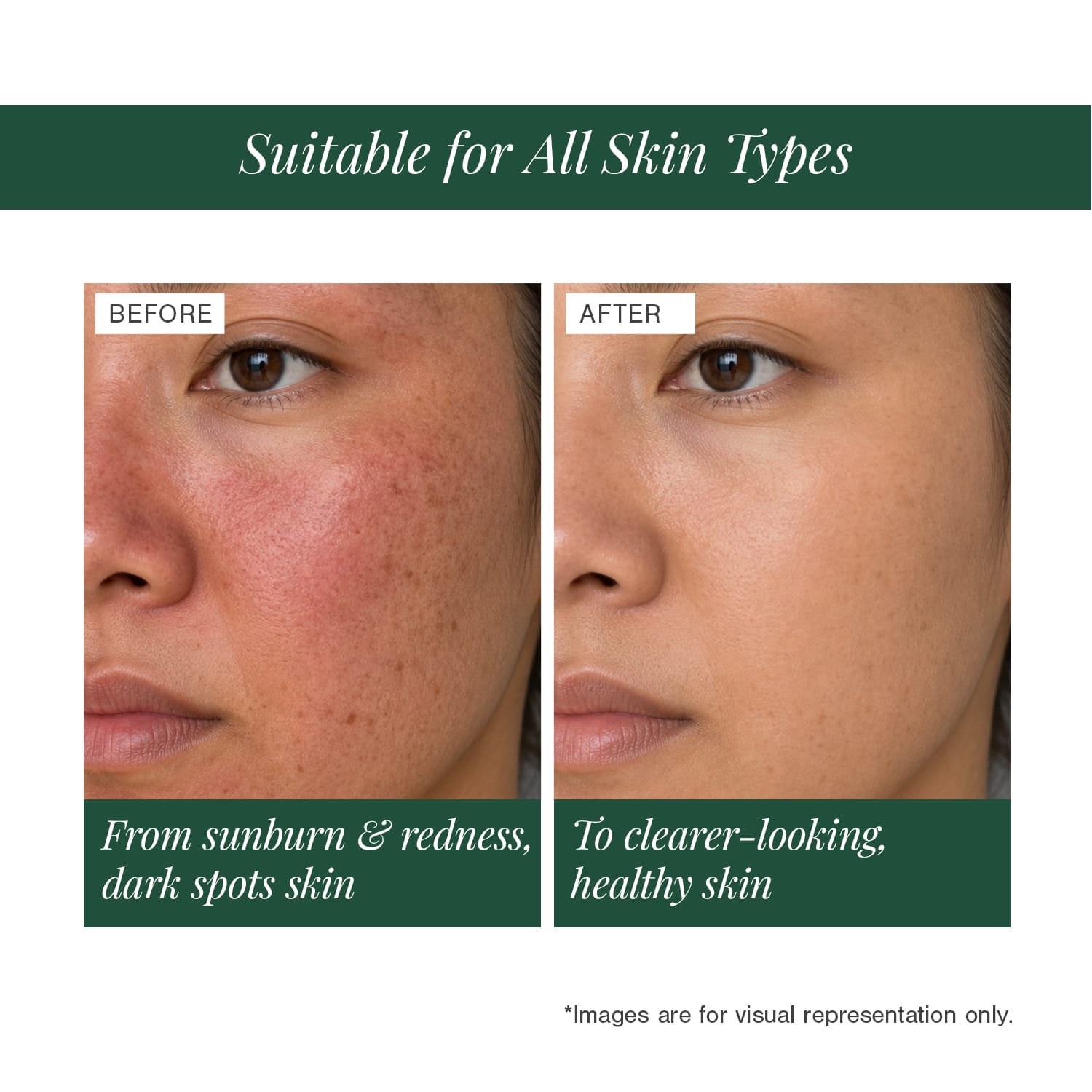 Moisturising Mineral Sunscreen" to "Mineral Sunscreen SPF 40 — Certified Organic 
