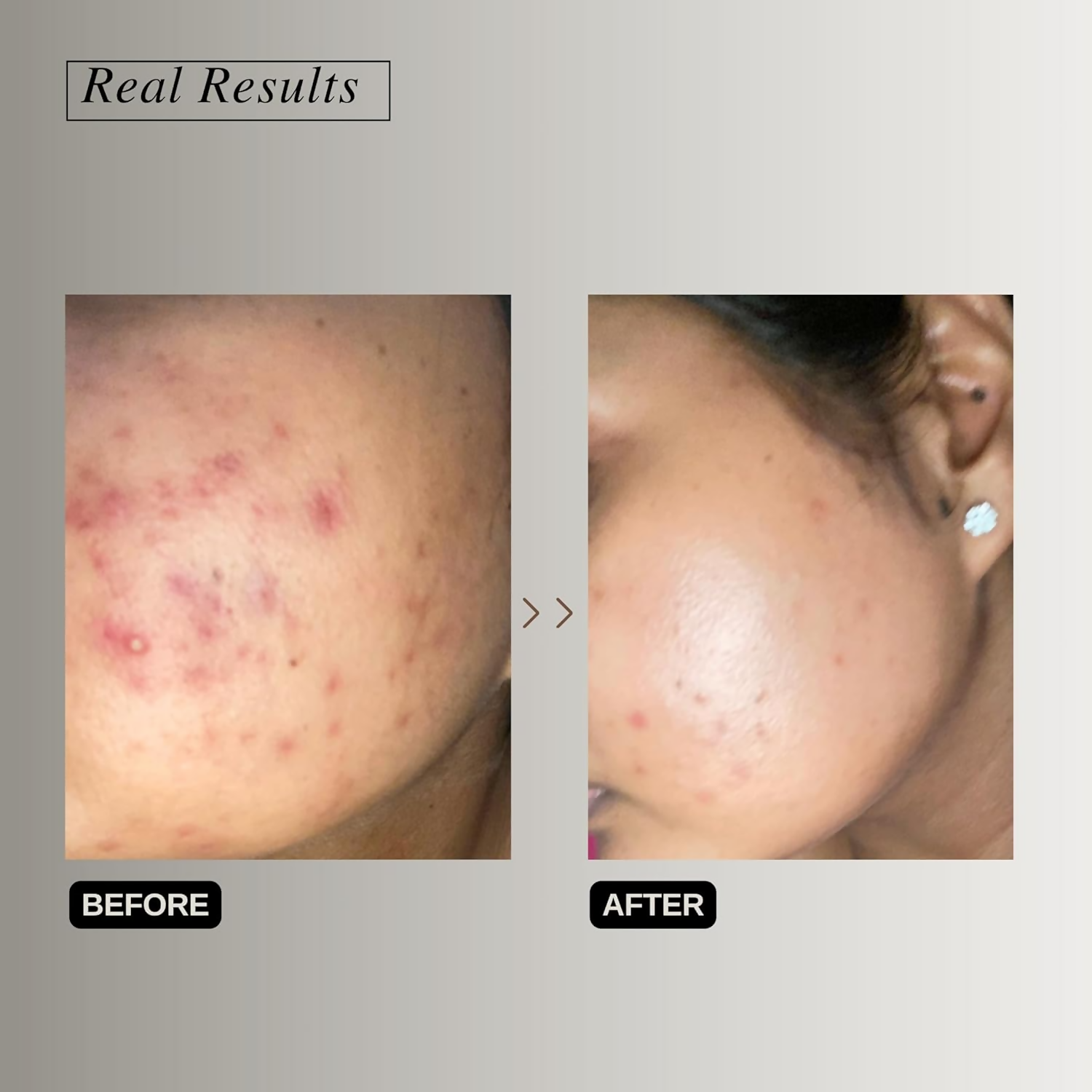 The Formularx Barrier Relief Ceramide Lightweight Moisturizer With Niacinamide & Hyaluronic Acid  Grab2Buy The Formularx Grab2Buy
